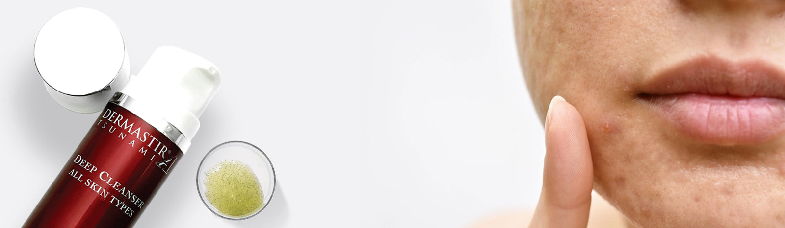 Acne-prone skin – Dermastir